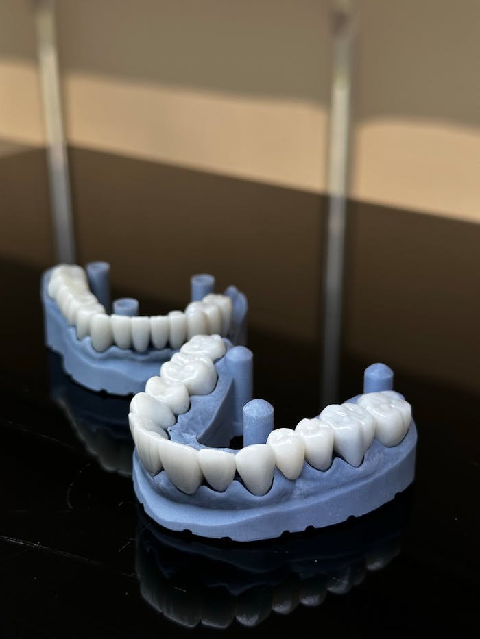 services-01 Two realistic dental impressions displayed on a shiny black surface with soft lighting.